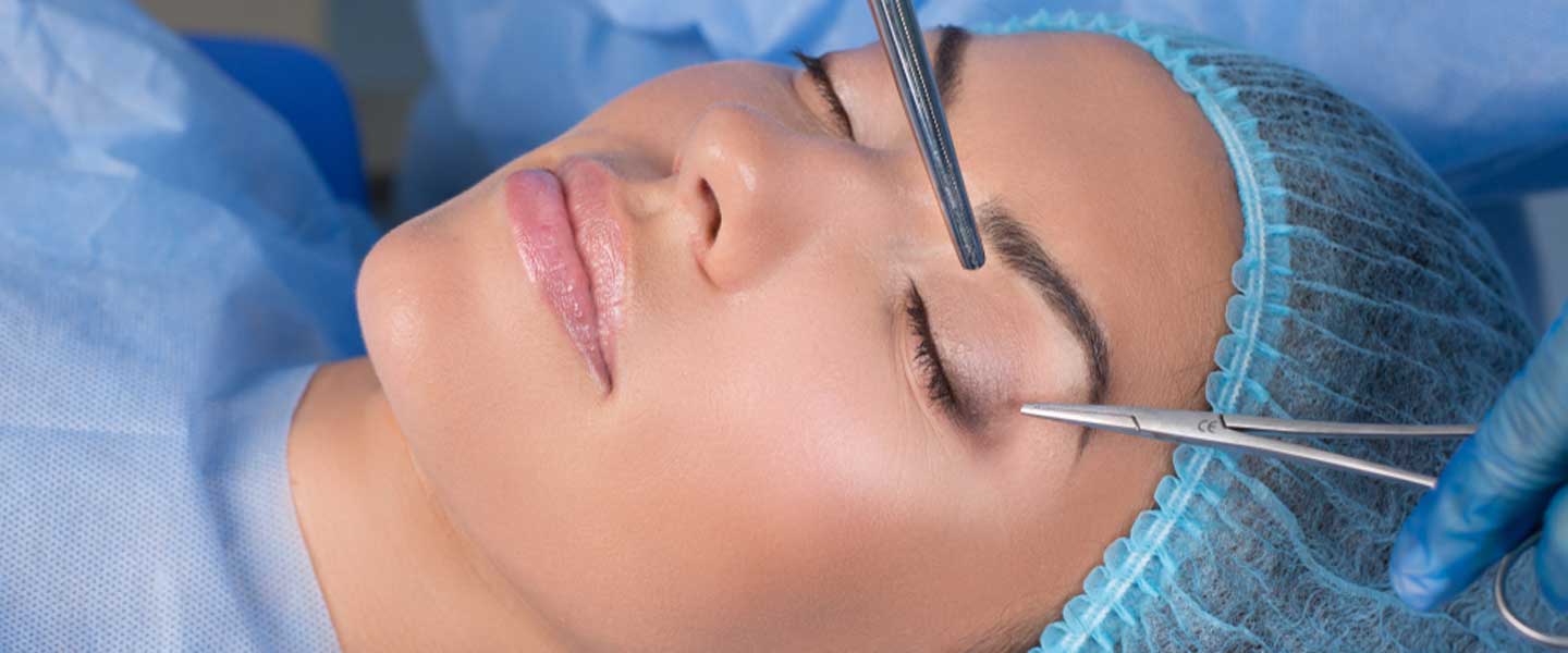 Apa Estetika Kelopak Mata (Blepharoplasty)?