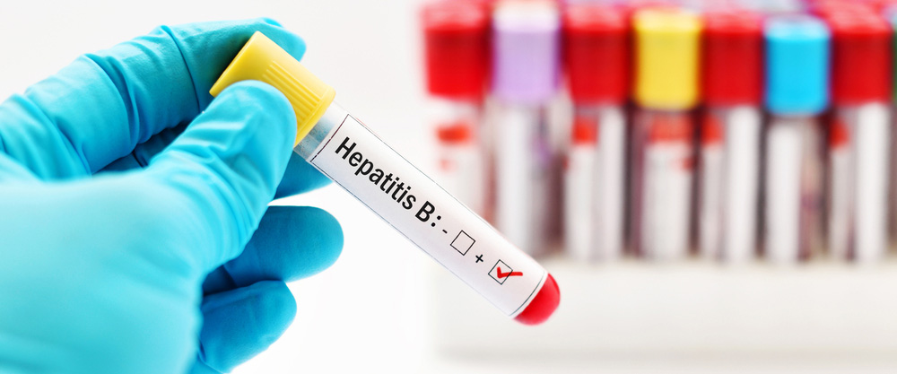 Apa Hepatitis B? Apa gejala lan cara perawatan?